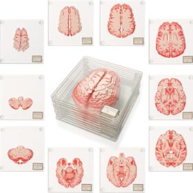 Anatomic Brain Specimen Coasters - Set of 10 Glass Novelty Drink Coasters with Storage Case – Unique Science & Medical Gift